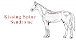 Zdrowie: Kissing Spine Syndrome